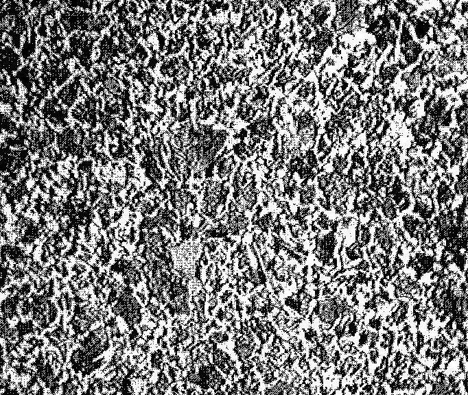 Micrograph 2: Microstructure of Normalized Plain Carbon Steel.