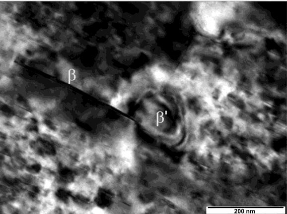 TEM investigations showed that the microstructure of Elektron 21 alloy aged at 250 C for 4 h consisted of enlarged phase precipitates and the elongated, needle-shaped precipitates of equilibrium
