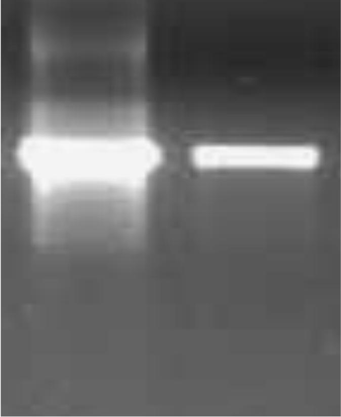 Interpretation: Spectrophotometric analysis and agarose gel electrophoresis will reveal the concentration and the purity of the genomic DNA.