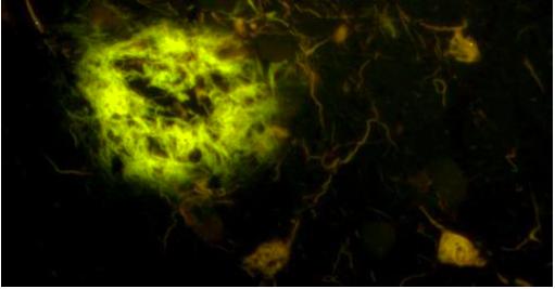 LUPAS Luminescent Polymers for in vivo Imaging of Amyloid Signatures A research project for innovative diagnostics for neurodegenerative disorders Funded by the European Union under the 7 th