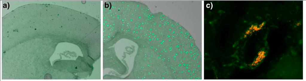 Figure 1: LCP staining of protein deposits in brain tissue from transgenic mouse models for AD and prion diseases. a) Brain tissue from an age matched control mouse.