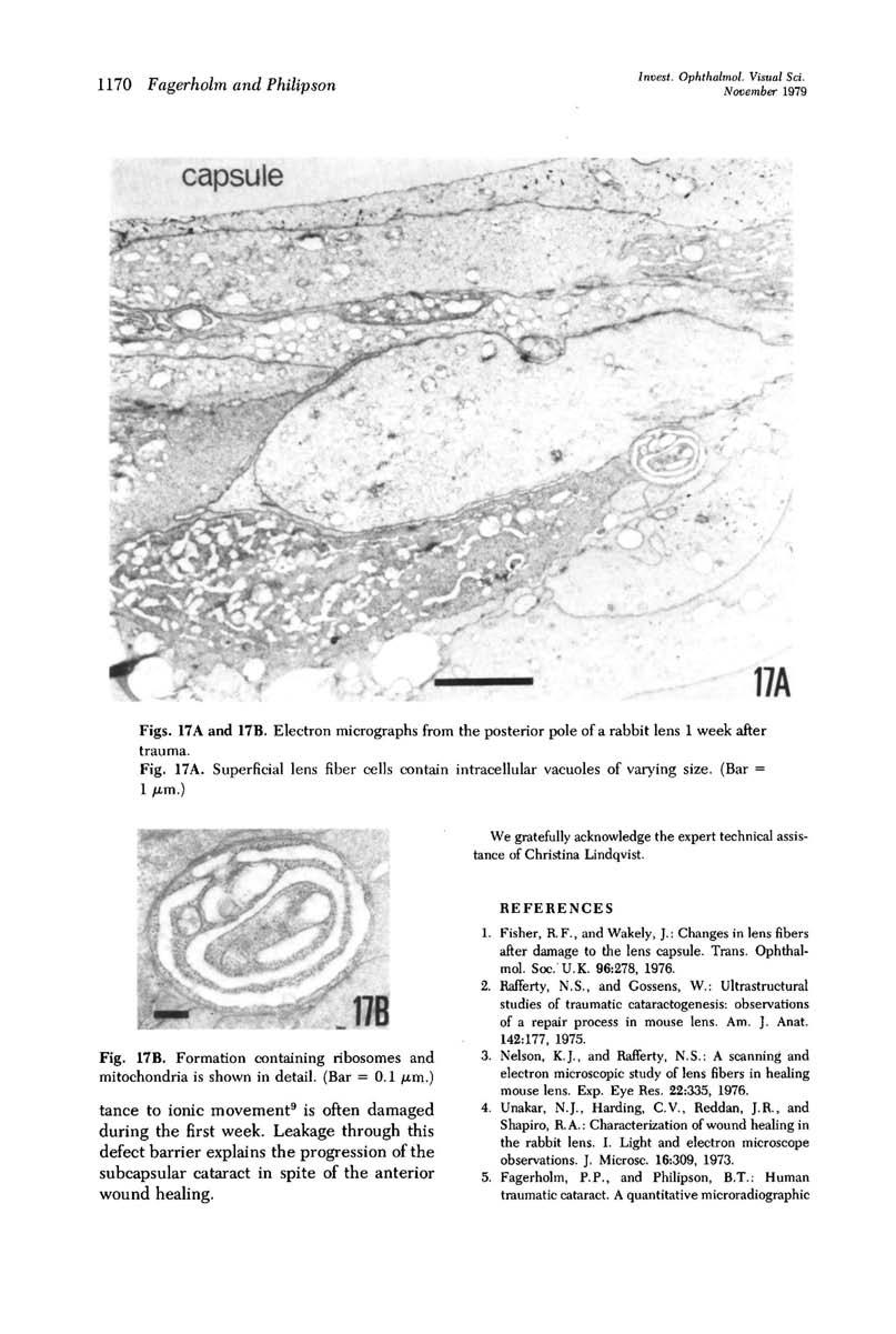 **%*«. : * ' 1170 Fagerholm and Philipson Invest. Ophthalmol. Visual Sci. November 1979 capsule Figs. 17A and 17B. Electron micrographs from the posterior pole of a rabbit lens 1 week after trauma.