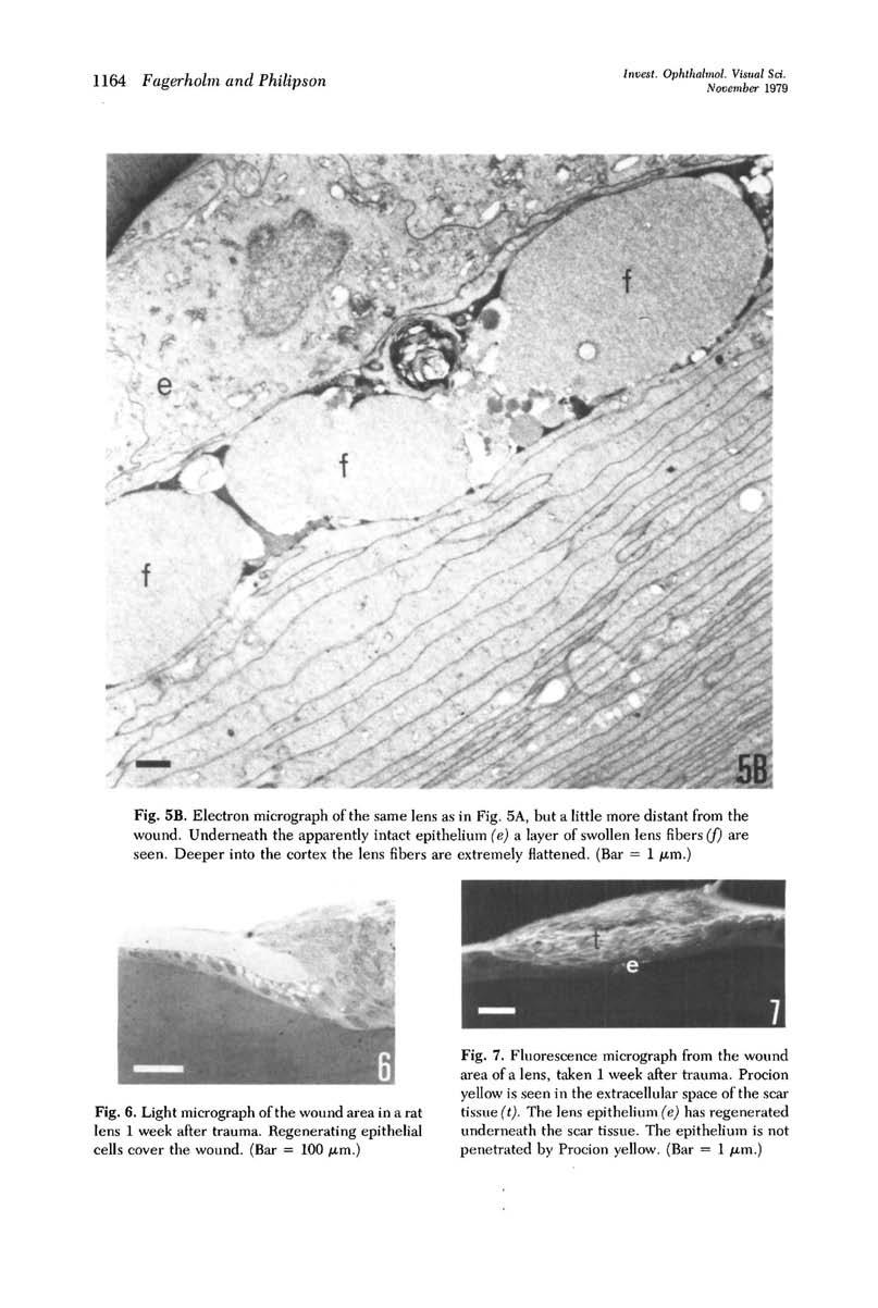 1164 Fagerholm and Philipson Invest. Ophthalmol. Visual Sri. November 1979 Fig. 5B. Electron micrograph of the same lens as in Fig. 5A, but a little more distant from the wound.