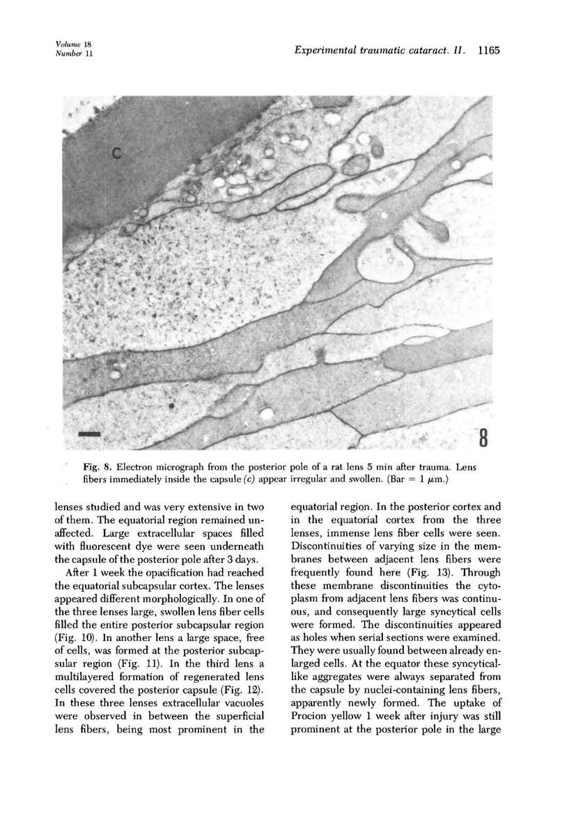 Volume Numbe, Experimental traumatic cataract. II. 1165 Fig. 8. Electron micrograph from the posterior pole of a rat lens 5 min after trauma.