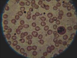 Platelets platelets Platelets are the smallest blood cells which are released by