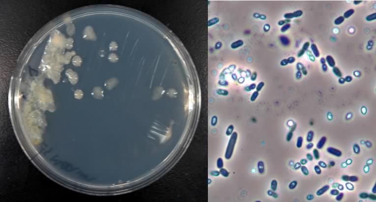 Soil Lab: Azotobacter enrichment results Soil Lab:
