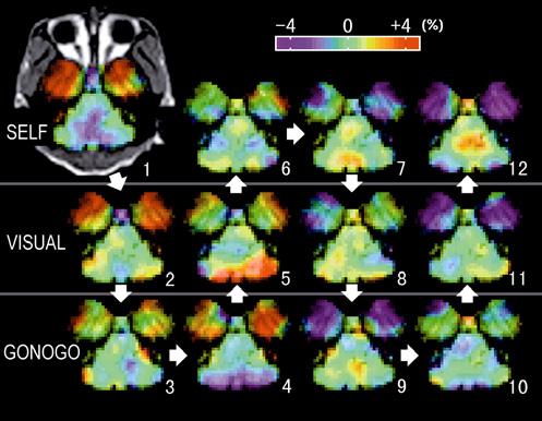 potential, magnetoencephalography, and positron emission tomography. SELF Figure 2. Regions activated in SELF task. SELF VISUAL GONOGO Figure 1.