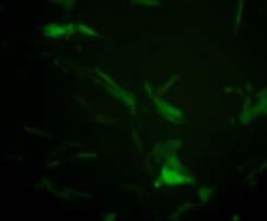 Imaging of tissue slices from luciferase-gfp (m21) labelled xenografts