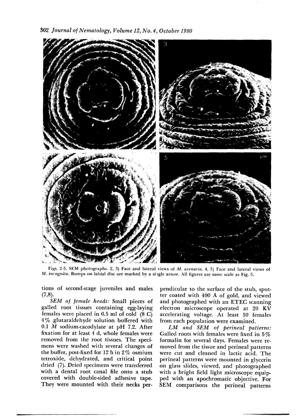 302 Journal of Nematology, Volume 12, No. 4, October 1980 Figs. 2-5. SEM photographs. 2, 3) Face and lateral views of M. arenaria. 4, 5) Face and lateral views of M. incognita.