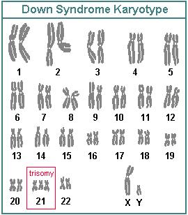 12. What kind of information can be derived from the diagram (karyotype) pictured above? a. the presence of extra or missing d.
