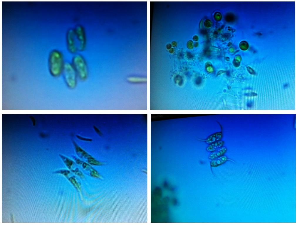 Mixed algae culture species under microscope.