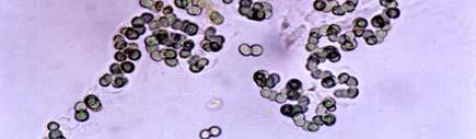 Lactobacillus brevis subsp.