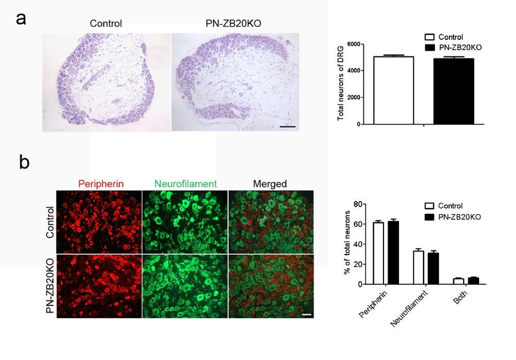 Supplementary Figure 2. Normal morphogenesis of DRG neurons in PN-ZB20KO mice. (a) Nissl staining showed no difference of total neurons between control and PN-ZB20KO mice.