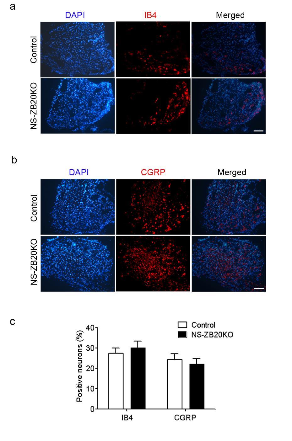 Supplementary Figure 4. ZBTB20 ablation does not alter the generation of IB4 or CGRP neurons in DRG of NS-ZB20KO mice.