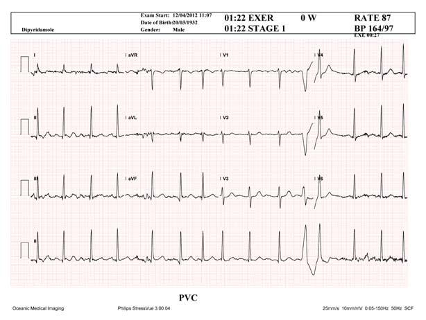Examples of useful attachments might include a PDF from an ECG or a