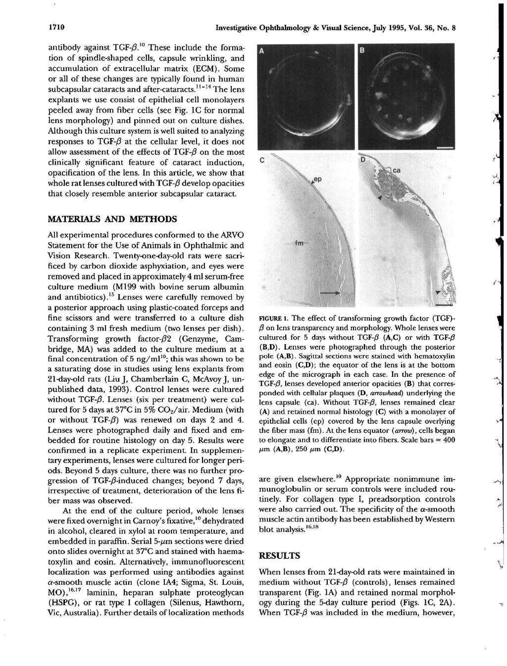 1710 Investigative Ophthalmology & Visual Science, July 1995, Vol. 36, No. 8 antibody against TGF-/?