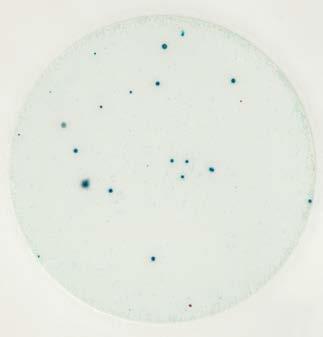 Figure 13 Figure 14 Aerobic bacteria count = 136 Colonies along the edges of the plate may