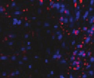 Results: Cells cultured in BD Mosaic were tight and compact, in comparison to other media tested.