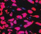 As with traditional methods, MSCs expanded using the BD Mosaic hmsc SF cell culture environment reliably retain their