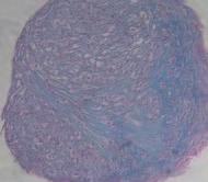 Cells were stained with Alcian blue to detect chondrocytes. Unexpanded, uninduced cells (left) were also stained for comparison.