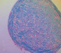 After 4 days of co-culture, T-cells were stained with BrdU and analyzed for T-cell proliferation.