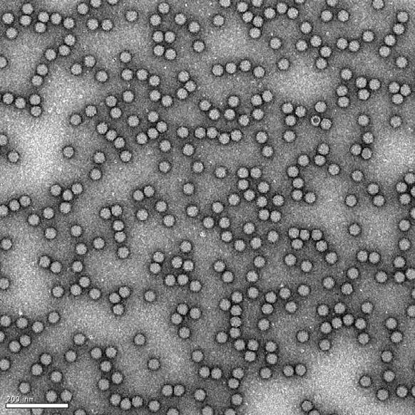Adeno associated virus (AAV) AAV member of Parvoviridae family 25 nm diameter (small), non-enveloped (stable) ssdna genome of
