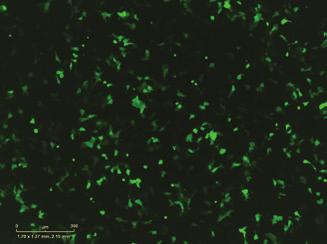 Results High-efficiency DN transfection in human stem cells