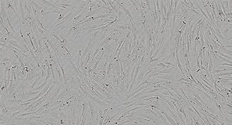 ESCs mrn GFP mrn, 250 ng/well Essential 8 Vitronectin 50,000 cells/well ipsc-derived NSCs mrn C MSCs mrn H9 ESCs, GFP mrn Transfection
