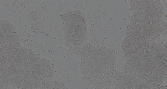 ng/well CTS StemPro MSC SFM CTS CELLstart Substrate 25,000 cells/well MSCs, GFP mrn Transfection efficiency: 40% Figure 6.