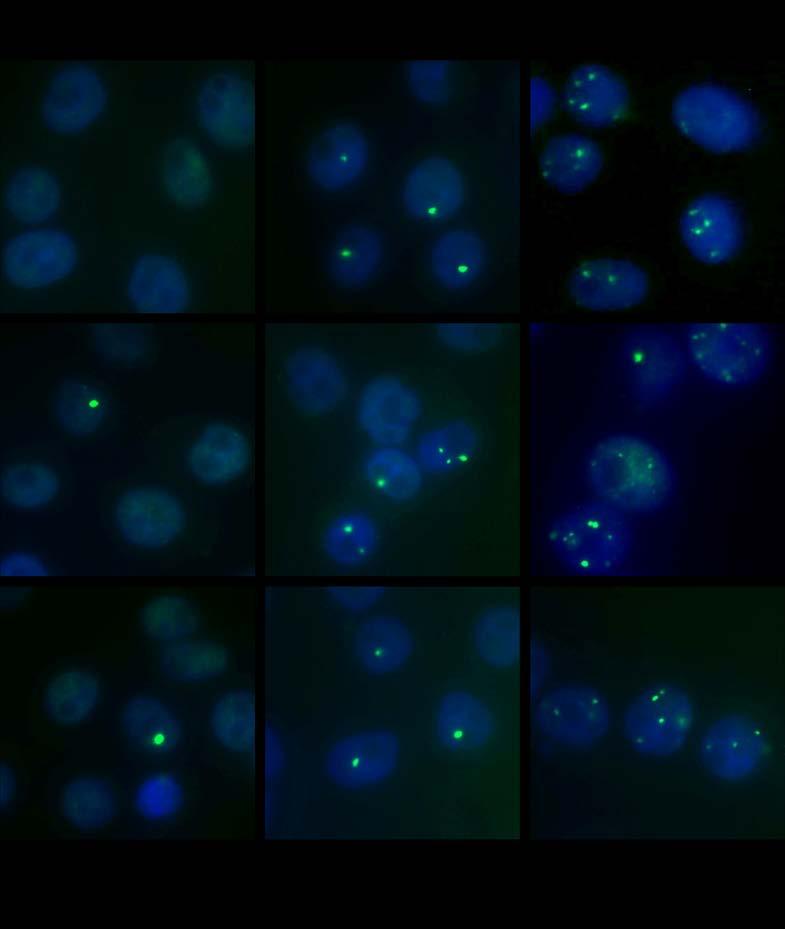 Supplementary Figure 6. RGEN-induced DSBs in cells detected by TP53BP1 staining.