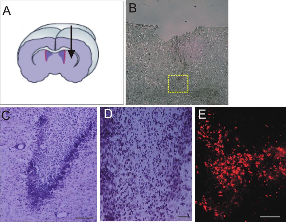 Biodegradation of Medical Purpose Polymeric Materials and Their Impact on Biocompatibility 13 Figure 1. Inflammatory response after 3 days post injection of PEG-Silica gel into rat striatum.