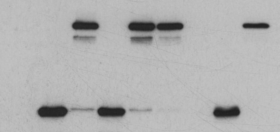 2 µg plasmid at a plasmid:transfection reagent ratio of 1:2 (9 µl K2 Transfection Reagent) without or with K2 Multiplier treatment (-/+ Multiplier).