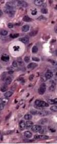 Tissue Similarity score Similarity score Colorectal Pancreas Non-small cell lung Breast Gastric Kidney Hepatocellular Ovarian Soft tissue sarcoma Non-Hodgkin s lymphoma Thyroid Prostate Melanoma
