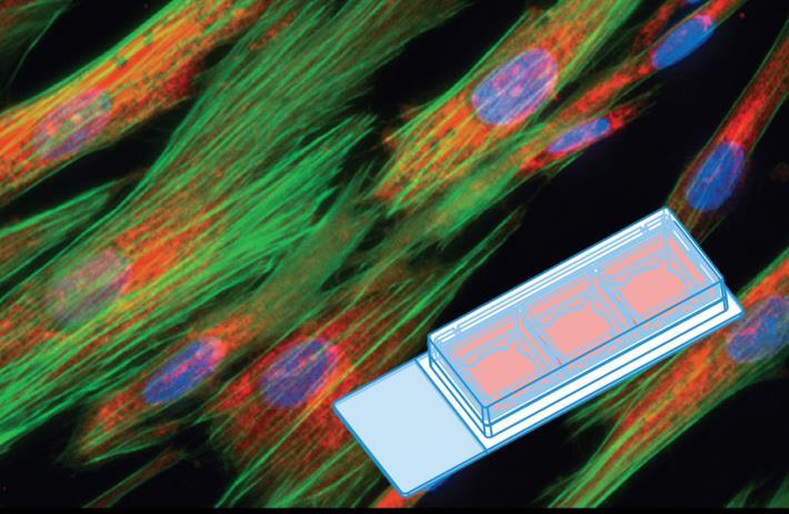 Immunofluorescence Staining Protocol for 3 Well Chamber, removable This Application Note presents a simple protocol for the cultivation, fixation, and staining of cells using the 3 Well Chamber,
