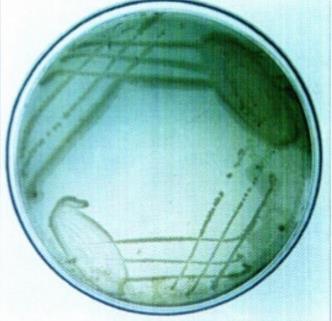 Staphylococcus aureus Pseudomonas