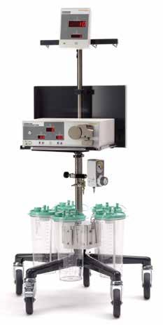 Ordering Information Hysteroscopic Morcellation Hysteroscopic Fluid Management System Hysteroscopic Fluid Management System 72202720* Hysteroscopic Fluid Management System, English (US) 72202721