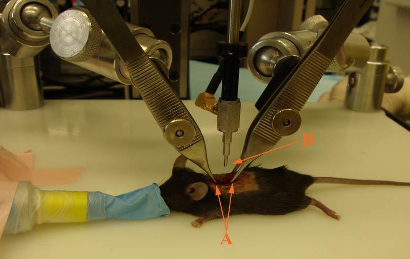 Figure 5. Impaction setup. After laminectomy, mouse is placed on Impactor stage. Spinal cord stabilizing forceps (A) are placed rostral and caudal to laminectomy site.