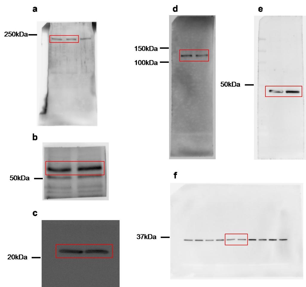 Supplementary Figure 10. Uncropped scans of blots shown in figure 7b.