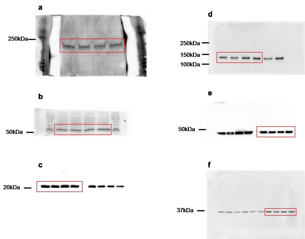 Supplementary Figure 7. Uncropped scans of blots shown in figure 4c.
