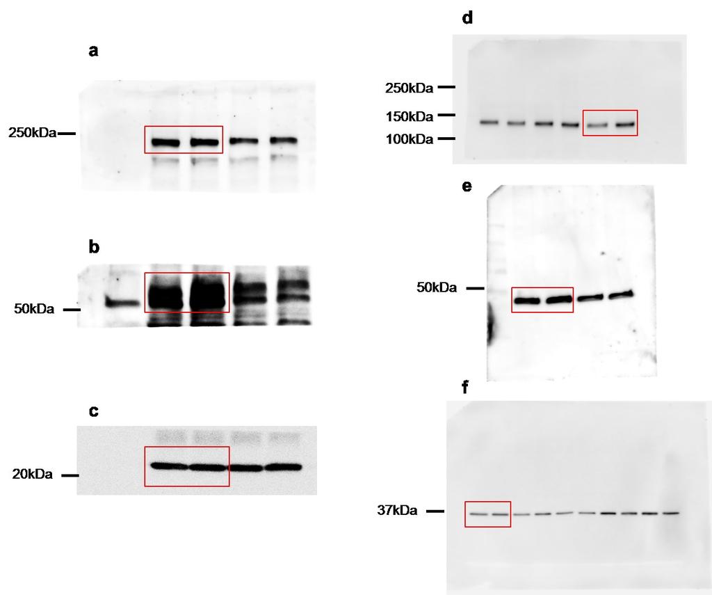Supplementary Figure 8. Uncropped scans of blots shown in figure 5f.