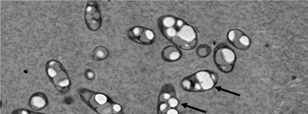 Fig. Transmission electron micrograph (TEM) of