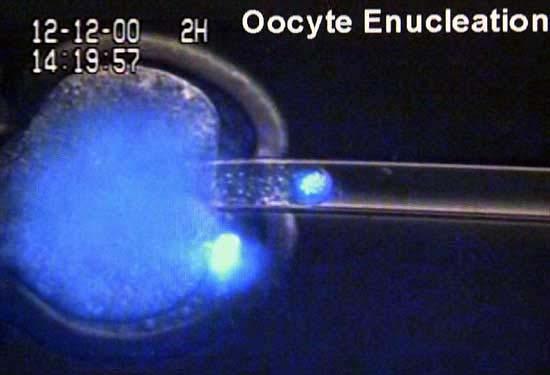 DNA is removed from a mammalian egg using suction