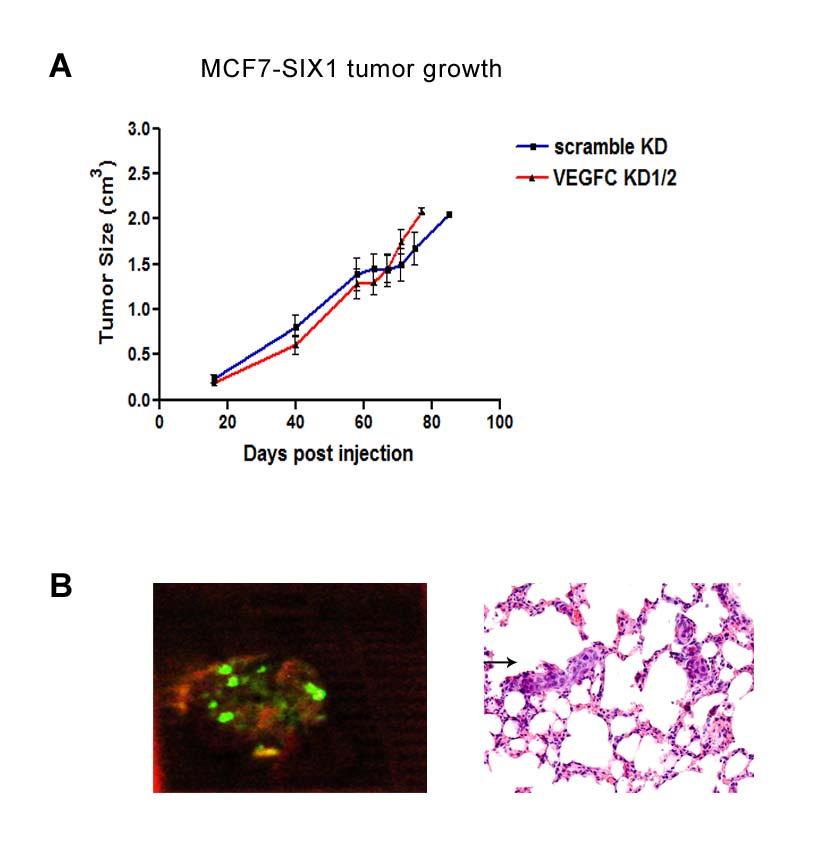 Supplementary Figure 5. (A) Primary tumor growth in MCF7-SIX1-scramble KD and MCF7-SIX1-VEGFC KD1/2 (two shrnas were used and combined in the figure).