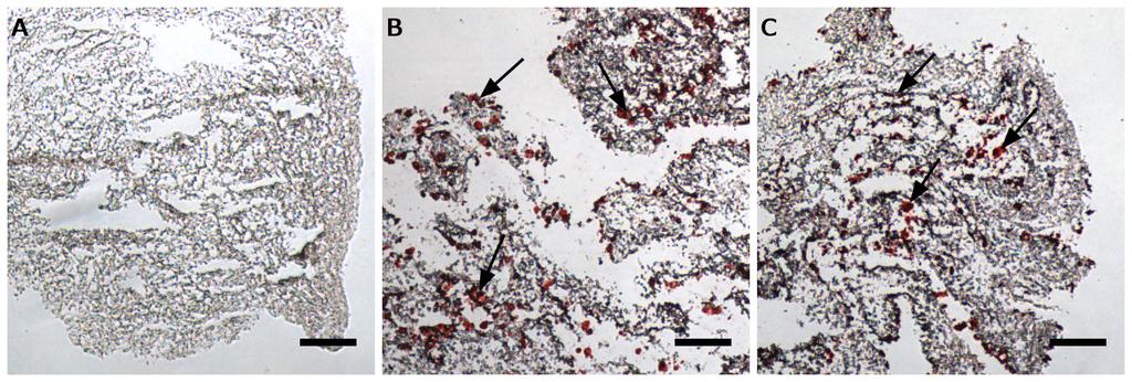 Figure 3.7: Donor 5 SM MPC construct sections stained with Oil Red O for lipid deposition.