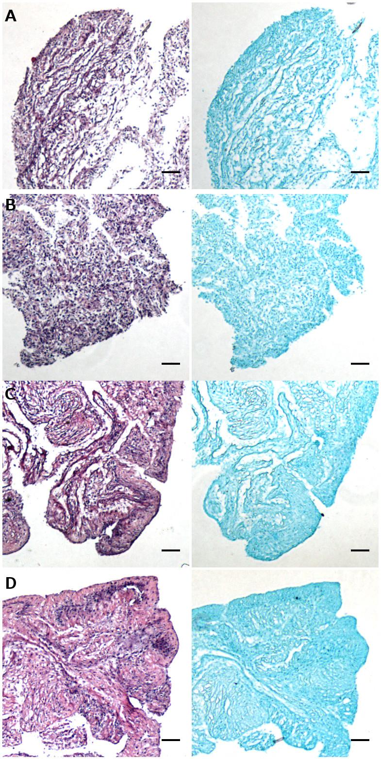 Figure 3.13: Donor 6 SM MPC constructs stained with H&E (left) and Alcian blue (right).
