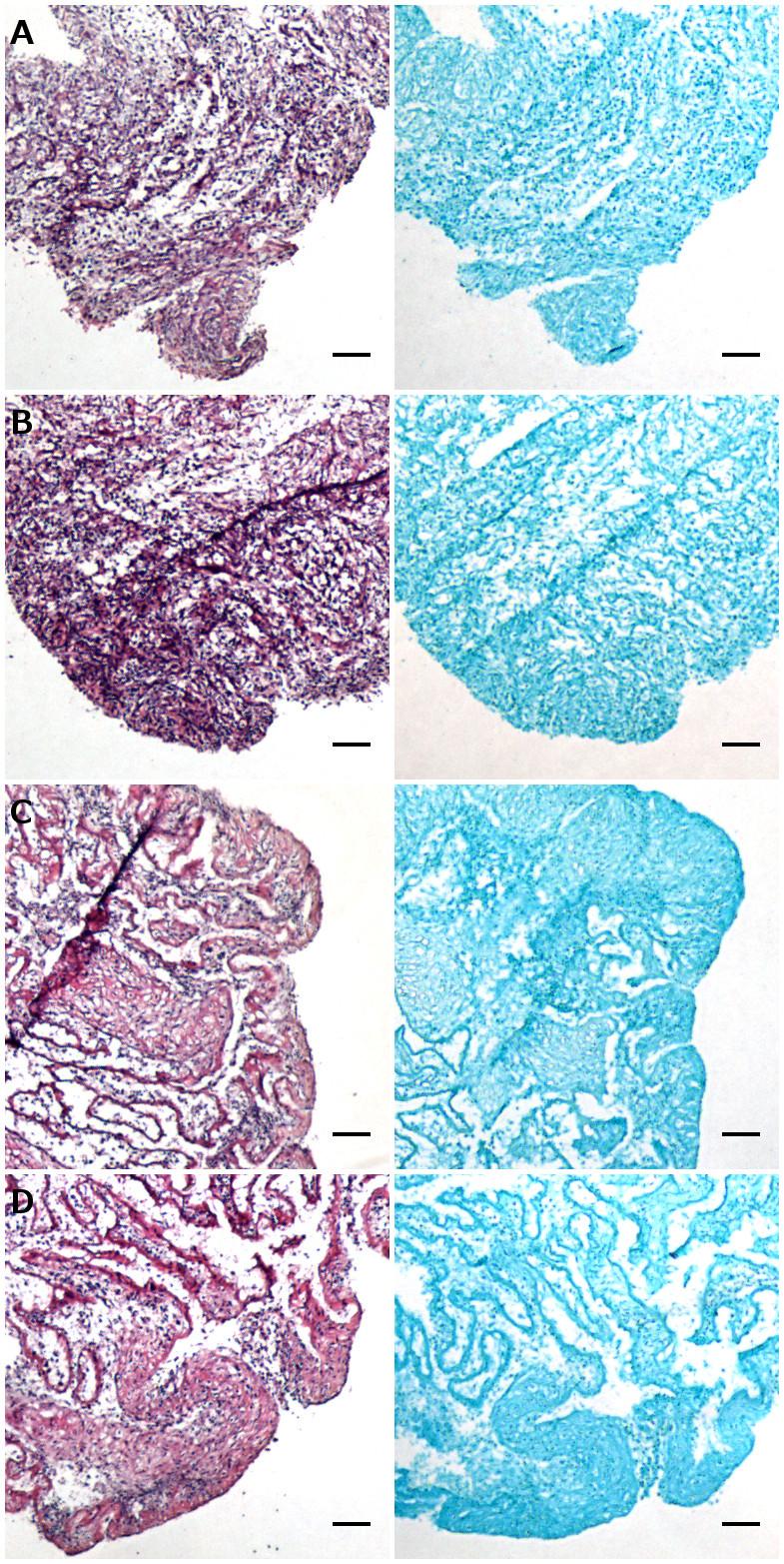 Figure 3.14: Donor 6 SF MPC constructs stained with H&E (left) and Alcian blue (right).