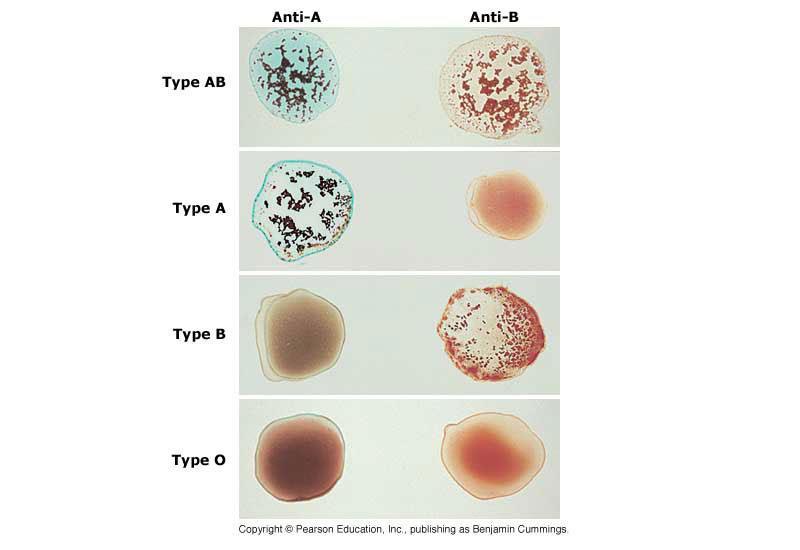 Antigens in the blood plasma Type B & O Type A & O Red blood cells from an