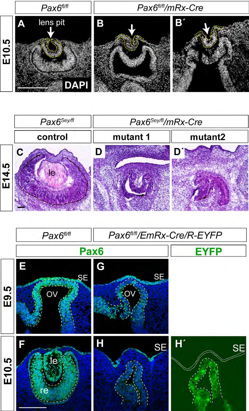 Supplementary Fig. S5. Pax6 elimination from early RPCs or OV neuroepithelium interferes with optic cup/lens pit morphogenesis. (A-B ) Transversal sections of E10.