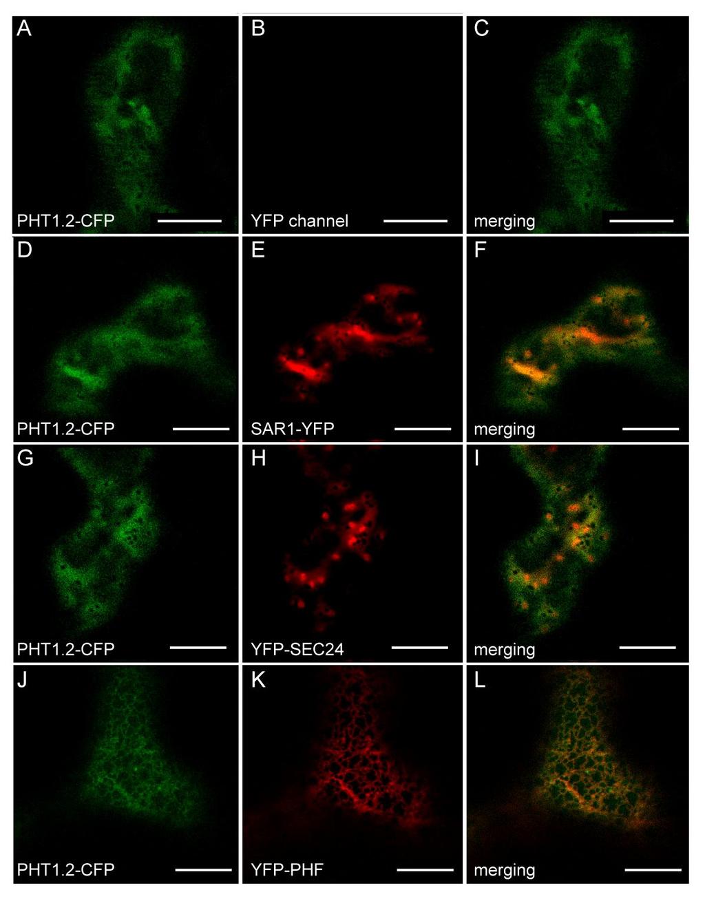 (A-L) Transient protein expression in N. benthamiana epidermal cells analyzed by confocal microscopy 48h post-infiltrations.