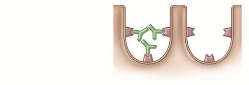 Note that an antigen is trapped between two antibodies.